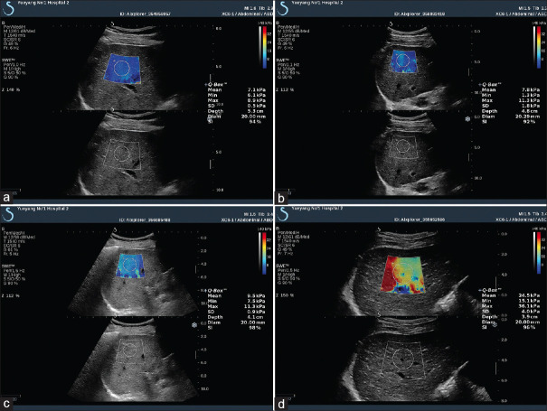 Figure 14