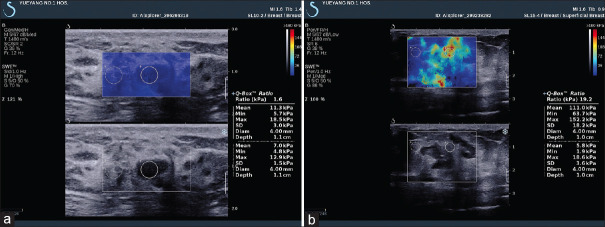 Figure 18