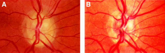 Figure 5  