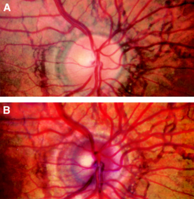 Figure 3  