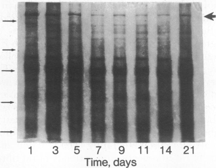 graphic file with name pnas00667-0390-a.jpg