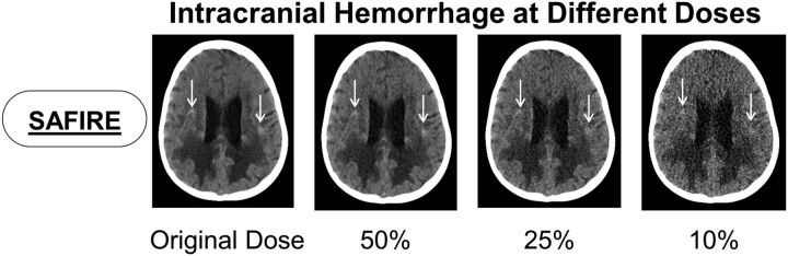 Fig 4.