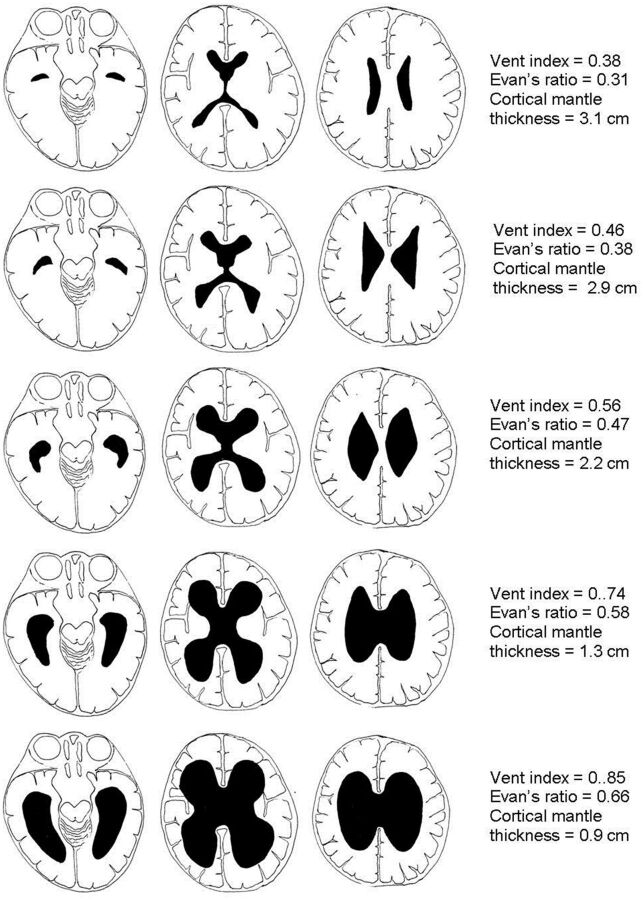 Fig 2.