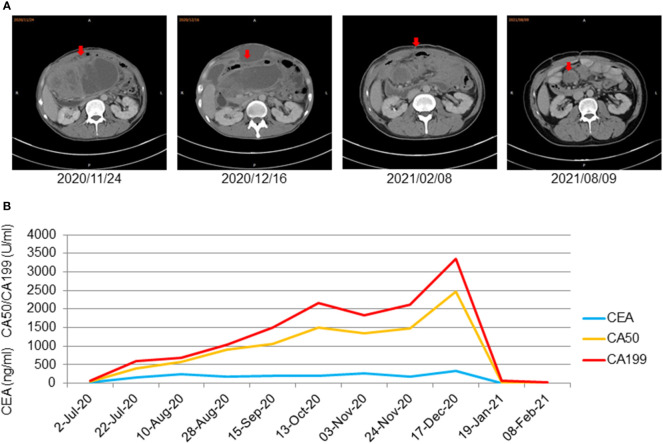 Figure 4