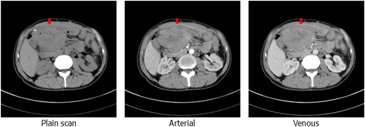 Figure 1