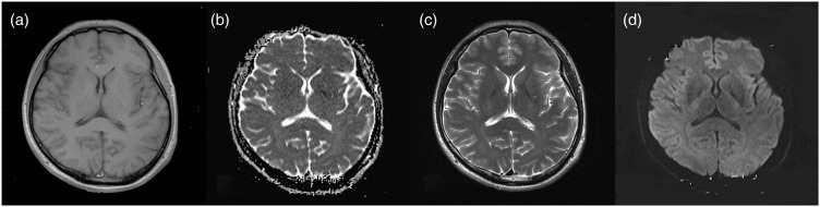 Figure 2.