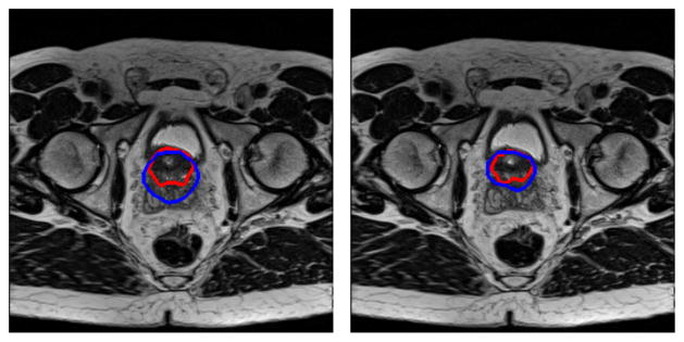 Fig. 13