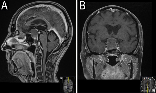 FIG. 1.