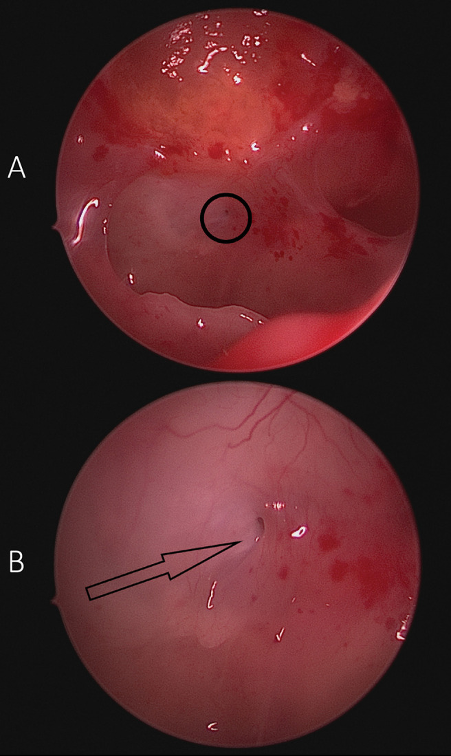 FIG. 5.