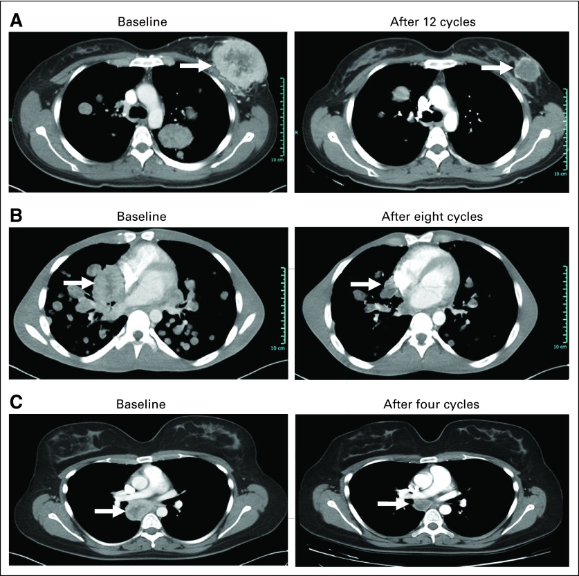 Fig 2.