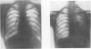 145-1