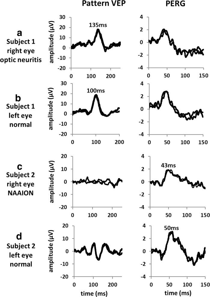 Fig. 2