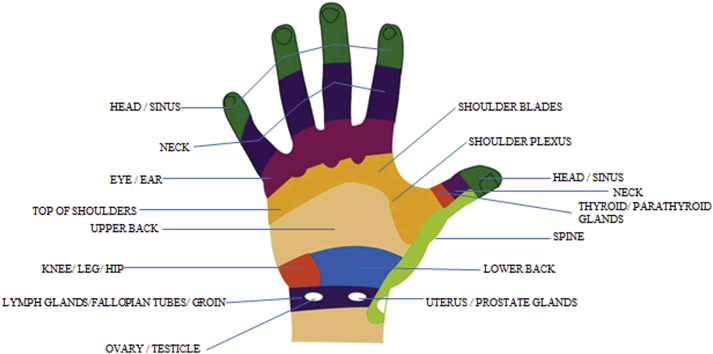 Fig. 1