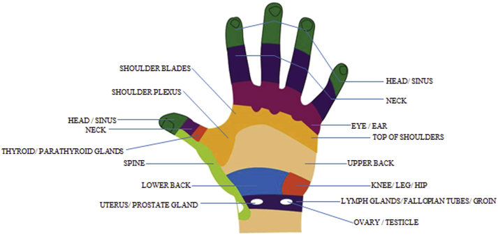 Fig. 2