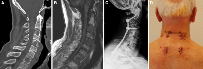 Fig. 1