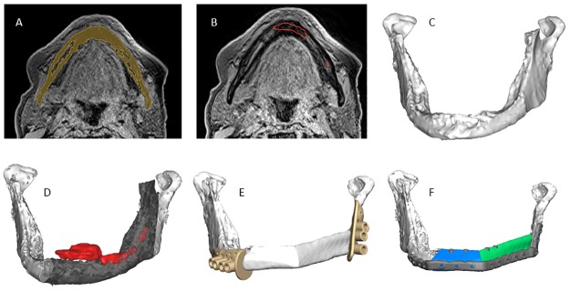 Fig 6