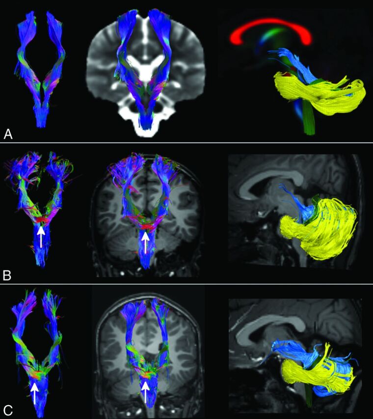 Fig 3.