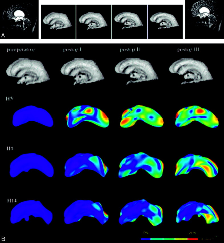 Fig 3.