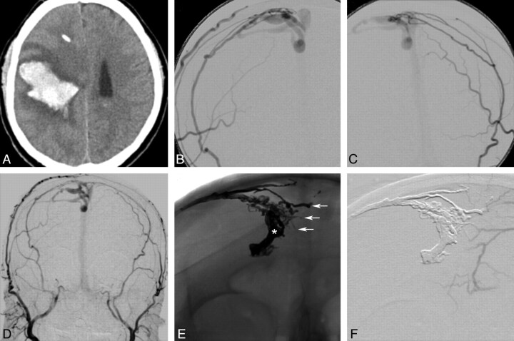 Fig 3.