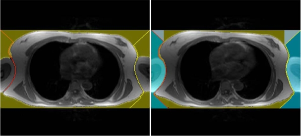 Fig. (3).