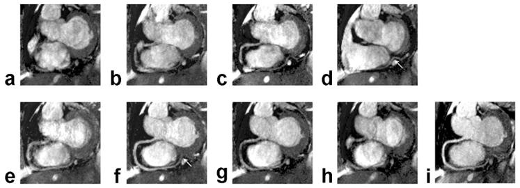 FIG. 8