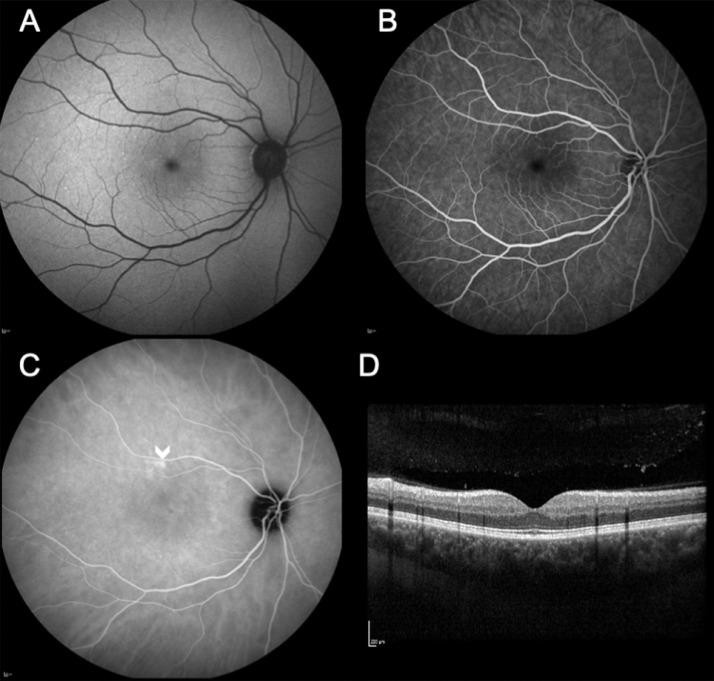 Fig. 2