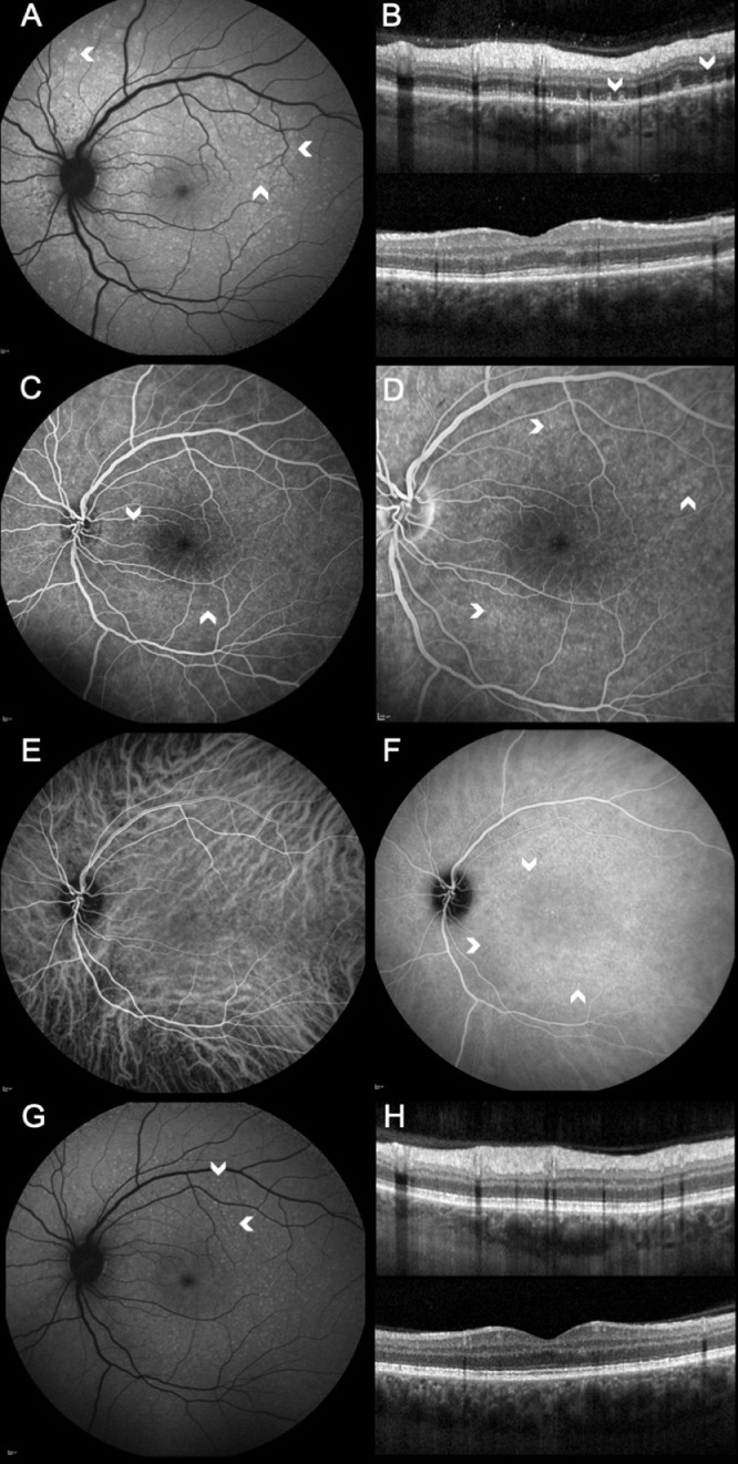 Fig. 4