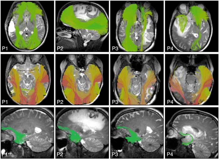 Fig. 13