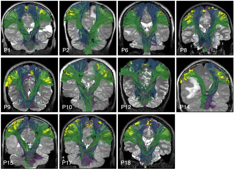 Fig. 10