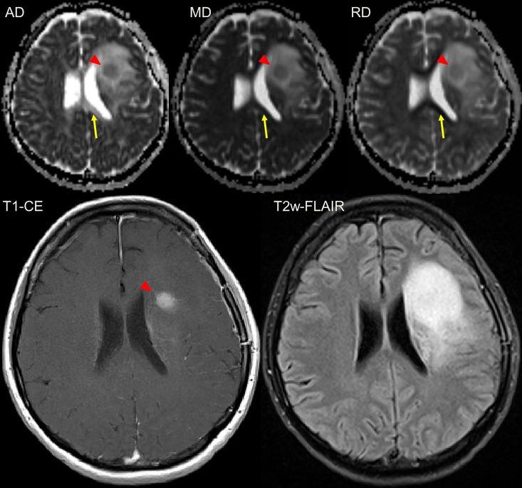 Fig 3