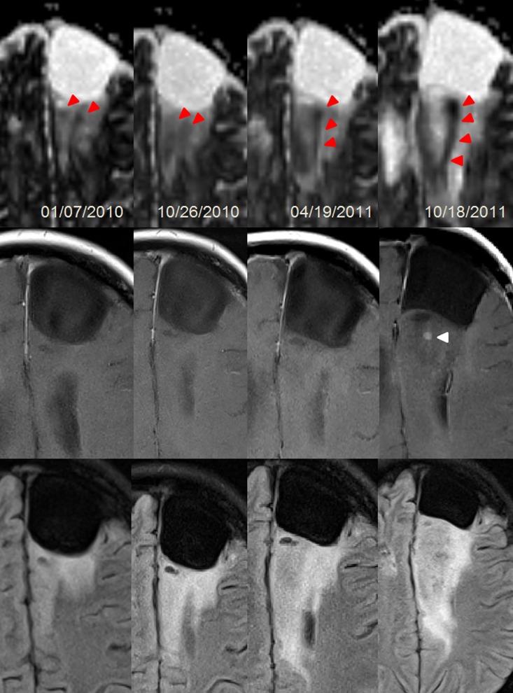 Fig 4