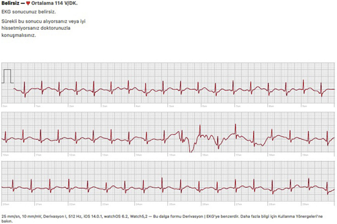 Figure 2