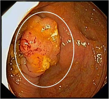 Fig. 1