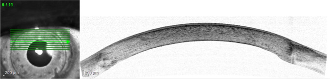 Fig. 5