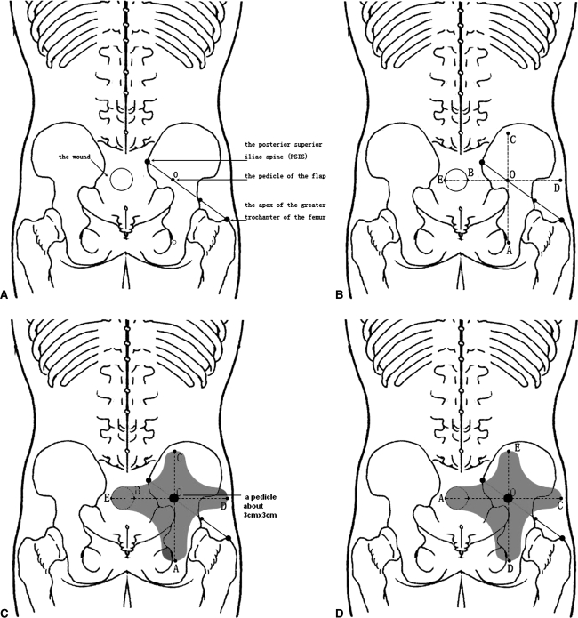 Fig. 1A–D