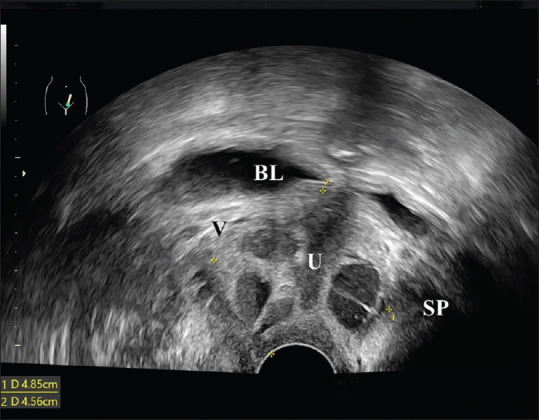 Figure 5