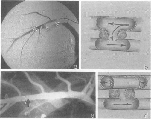 Figure 11.