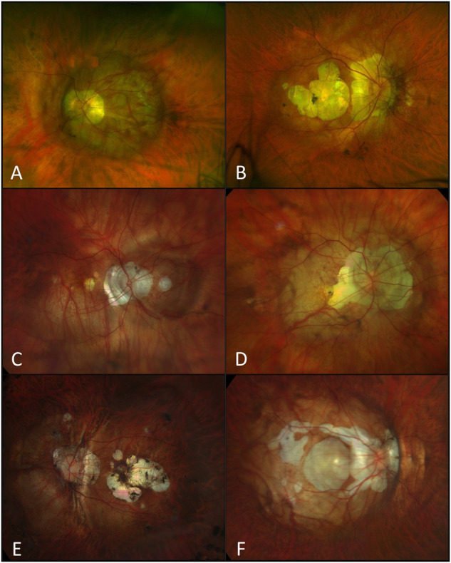 Fig. 1