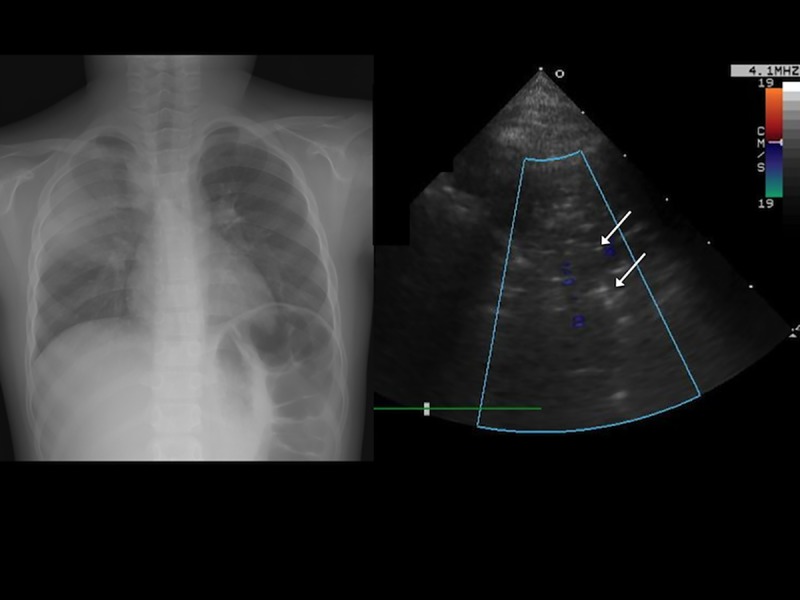 Fig 3