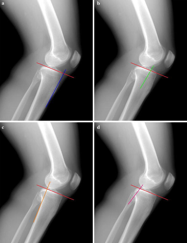 Fig. 6