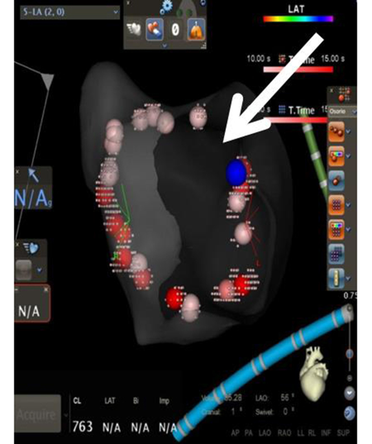 Figure 1b.