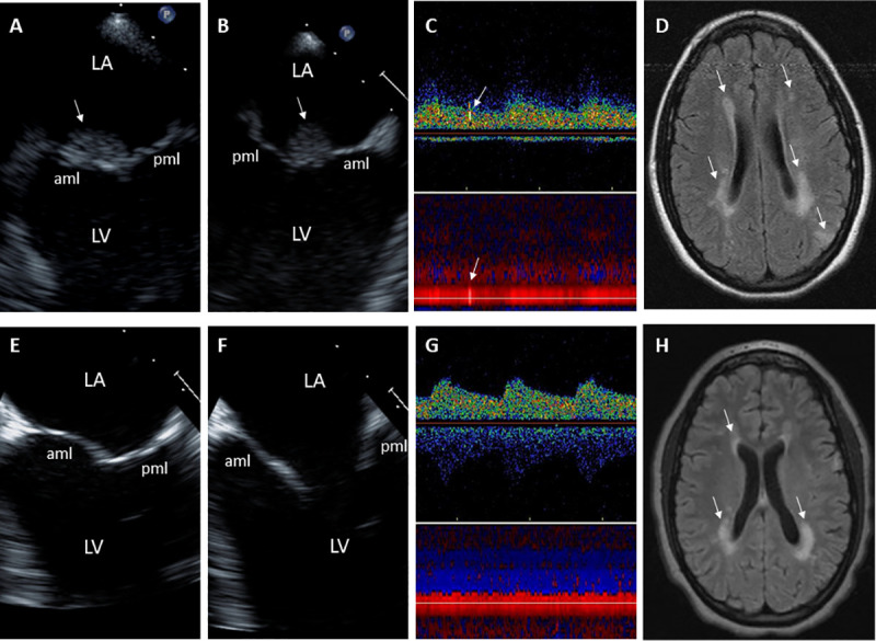 Fig 4