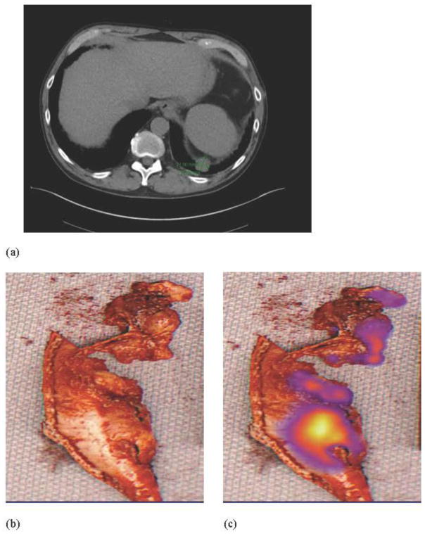 FIGURE 1