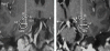 Figure. 4