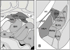 Figure. 1