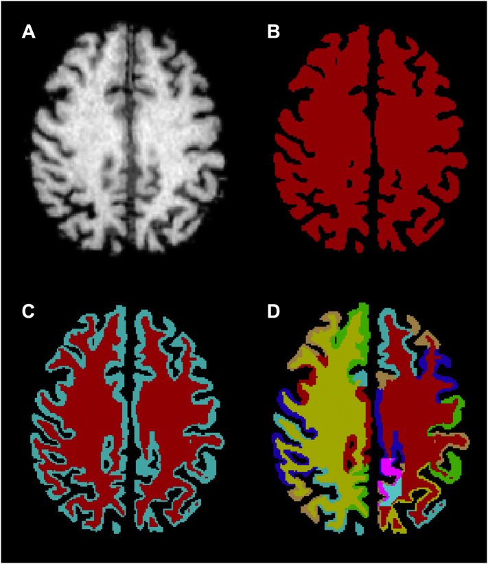 Fig. 2