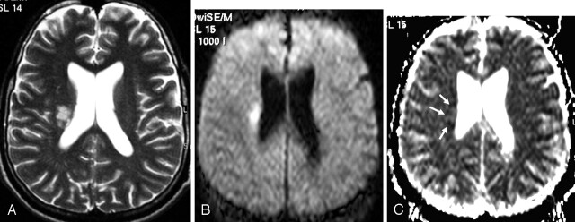 Fig 1.