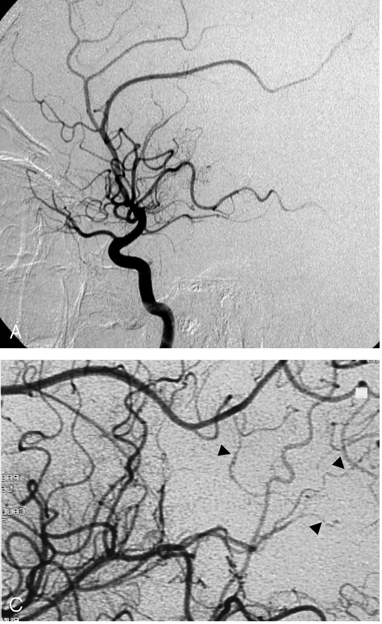 Fig 2.