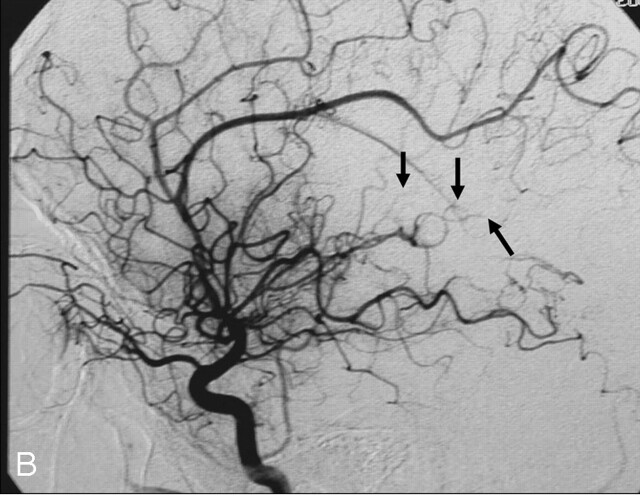 Fig 2.