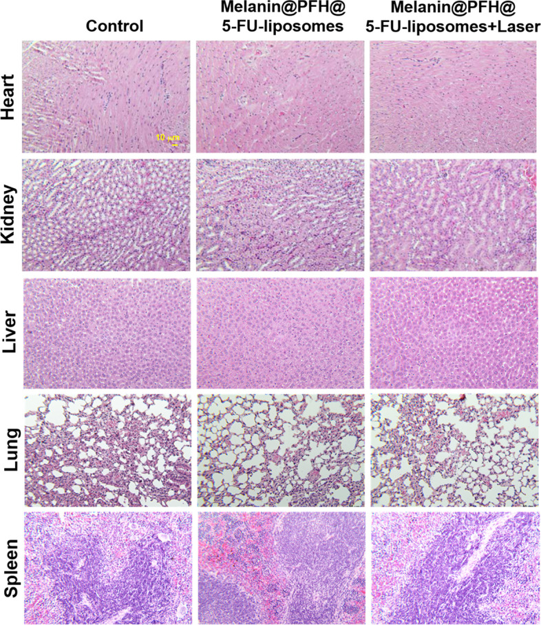 Fig. 10